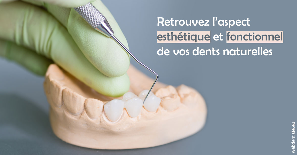 https://dr-levaux-jp.chirurgiens-dentistes.fr/Restaurations dentaires 1