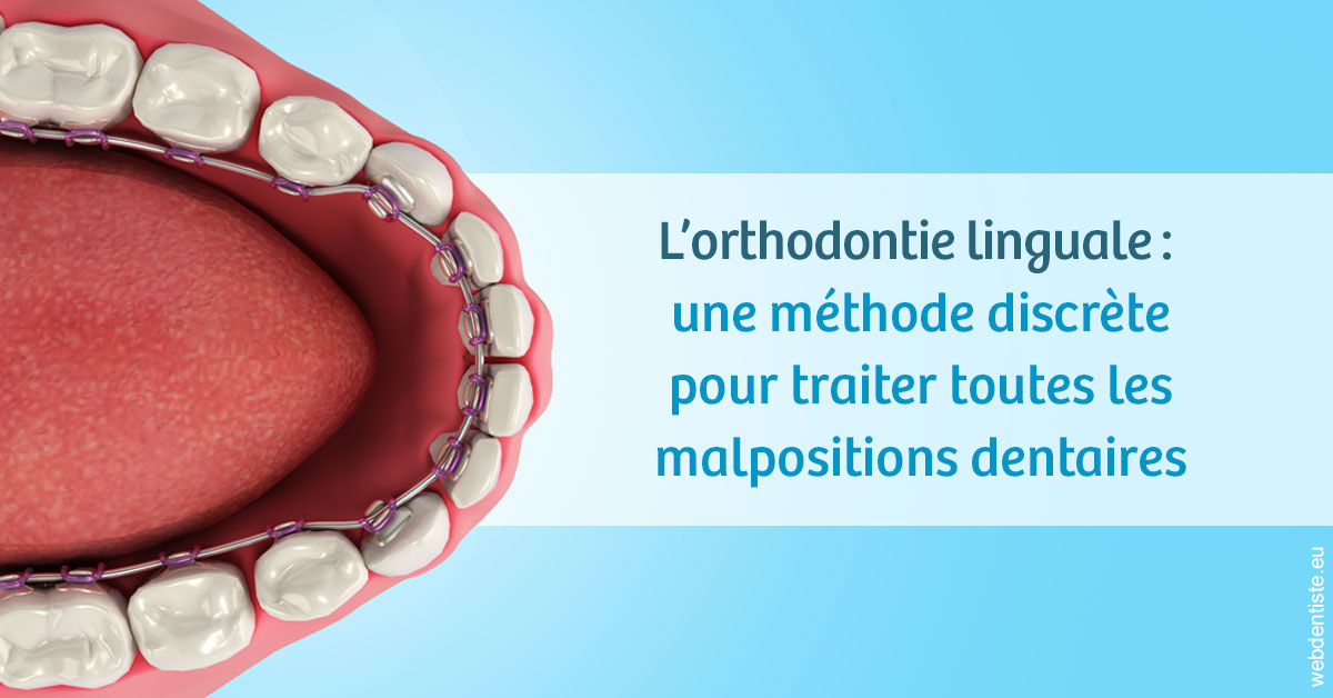 https://dr-levaux-jp.chirurgiens-dentistes.fr/L'orthodontie linguale 1