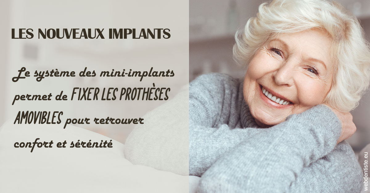 https://dr-levaux-jp.chirurgiens-dentistes.fr/Les nouveaux implants 1