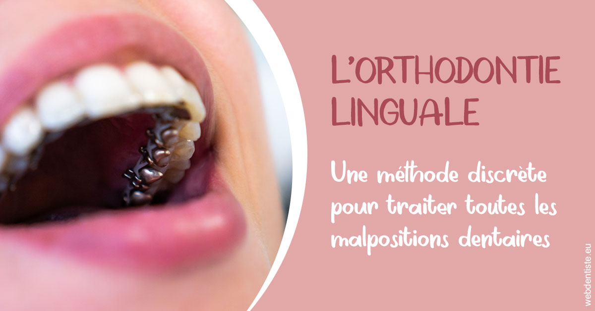 https://dr-levaux-jp.chirurgiens-dentistes.fr/L'orthodontie linguale 2