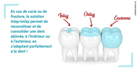 https://dr-levaux-jp.chirurgiens-dentistes.fr/L'INLAY ou l'ONLAY