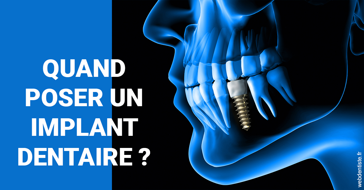 https://dr-levaux-jp.chirurgiens-dentistes.fr/Les implants 1