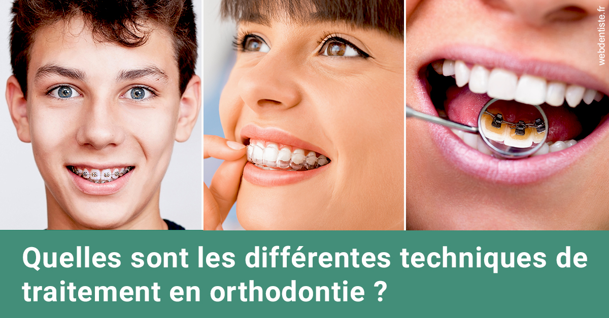 https://dr-levaux-jp.chirurgiens-dentistes.fr/Les différentes techniques de traitement 2
