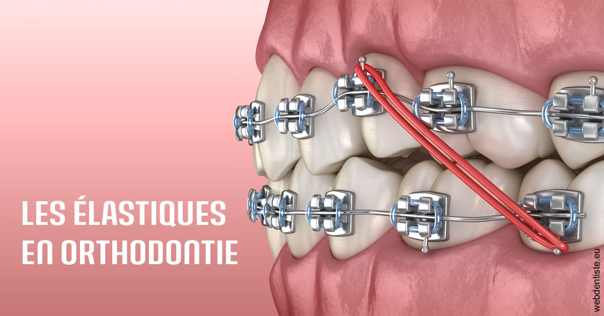 https://dr-levaux-jp.chirurgiens-dentistes.fr/Elastiques orthodontie 2