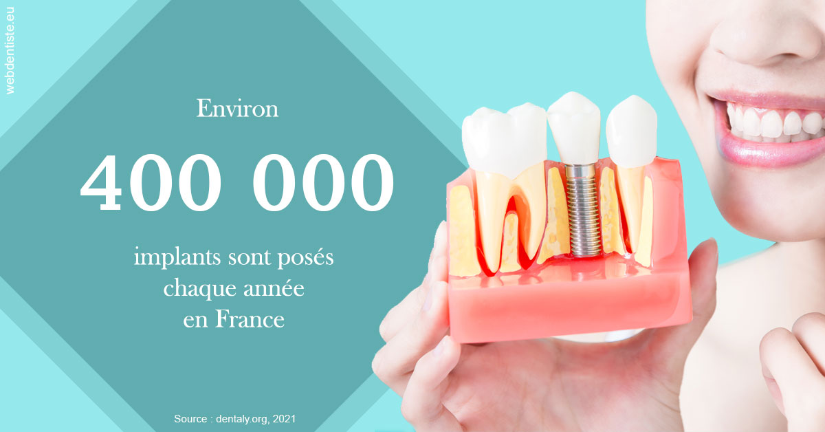 https://dr-levaux-jp.chirurgiens-dentistes.fr/Pose d'implants en France 2